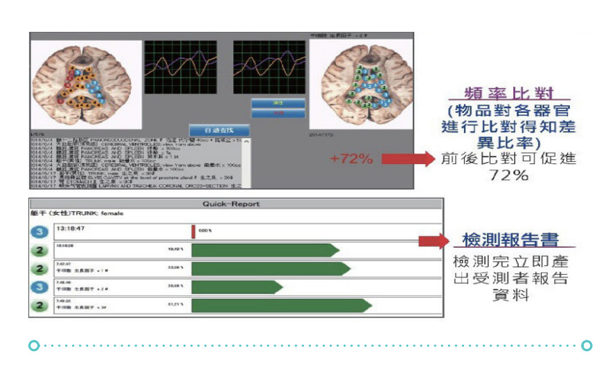 生物資訊檢測儀-檢測完立即產出受測者報告資料